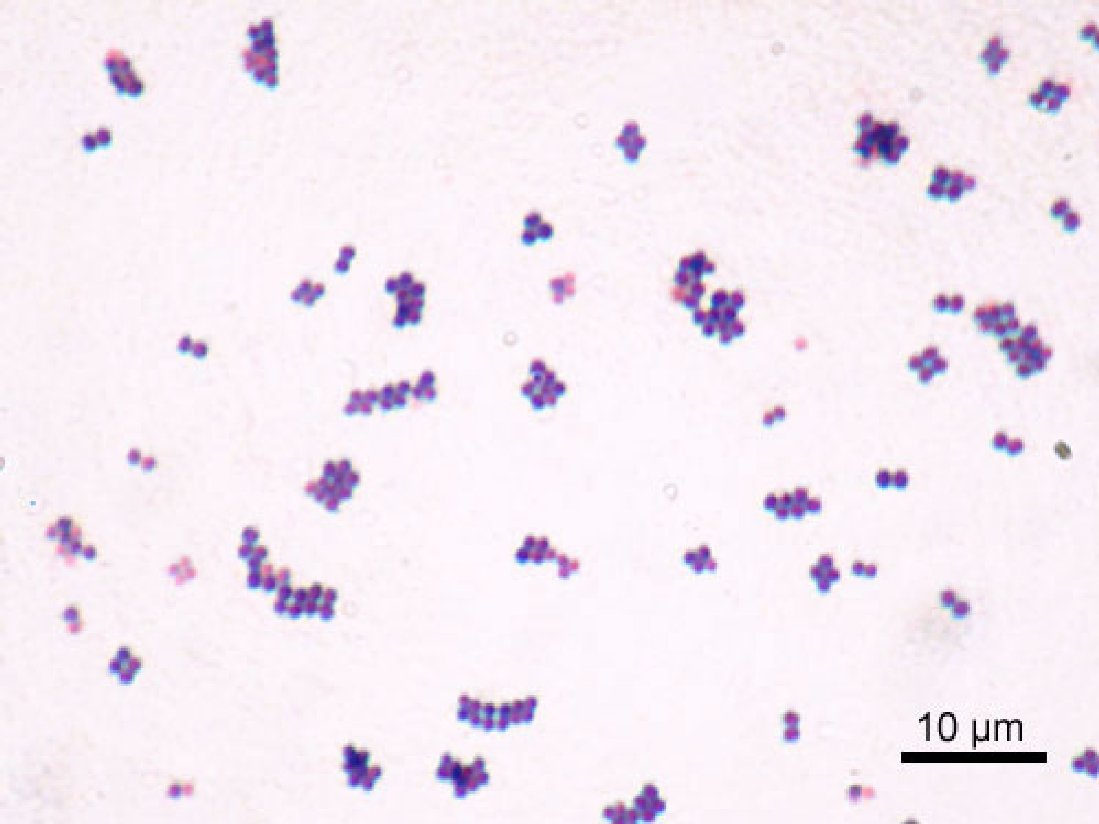 Staphylococcus_aureus_Gram